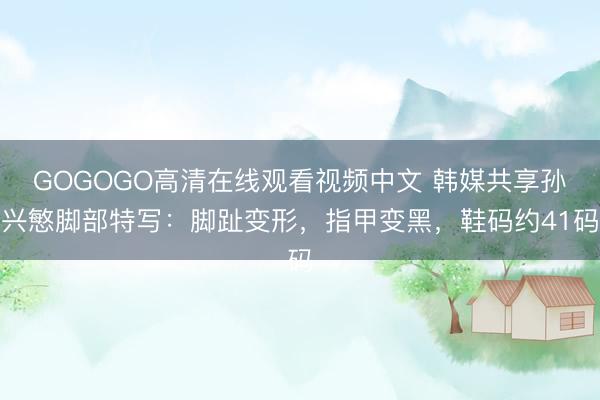 GOGOGO高清在线观看视频中文 韩媒共享孙兴慜脚部特写：脚趾变形，指甲变黑，鞋码约41码